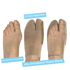 OS1st Bunion Brace HV3
